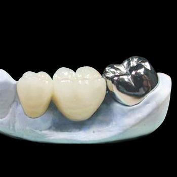 Dental Cobalt Chromium Alloy Metal Crown/Bridge