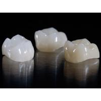 Natural Looking Dental E-Max Glass Ceramic Veneers