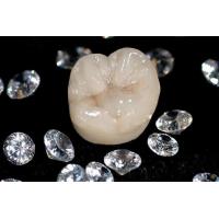 Excellent Dental Customized Teeth Zirconia Full Porcelain Crown/Bridge
